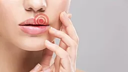 10 meilleurs analogues de l'acyclovir